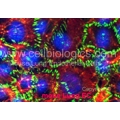 Diabetic Mouse Endothelial cells